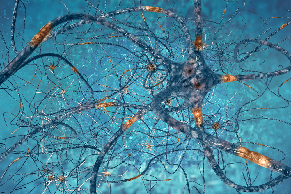 Digital Illustration Neurons By Vitstudio Via Shutterstock