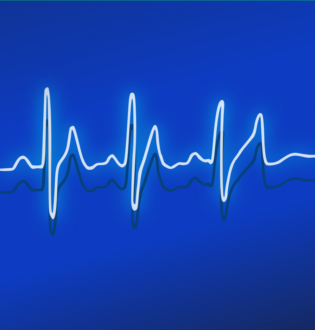 Ekg 158177 Via Pixabay Cc0 1.0