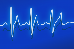 Ekg 158177 Via Pixabay Cc0 1.0