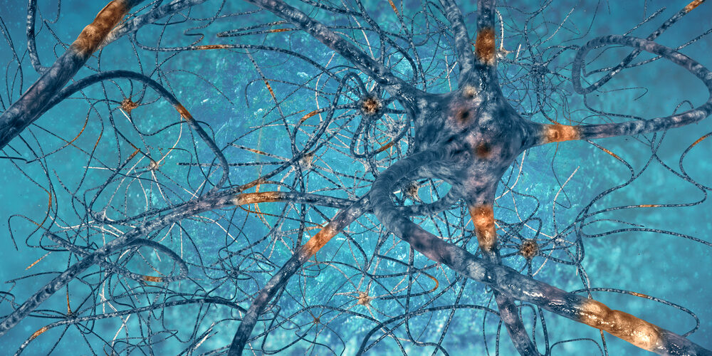 Digital Illustration Neurons By Vitstudio Via Shutterstock