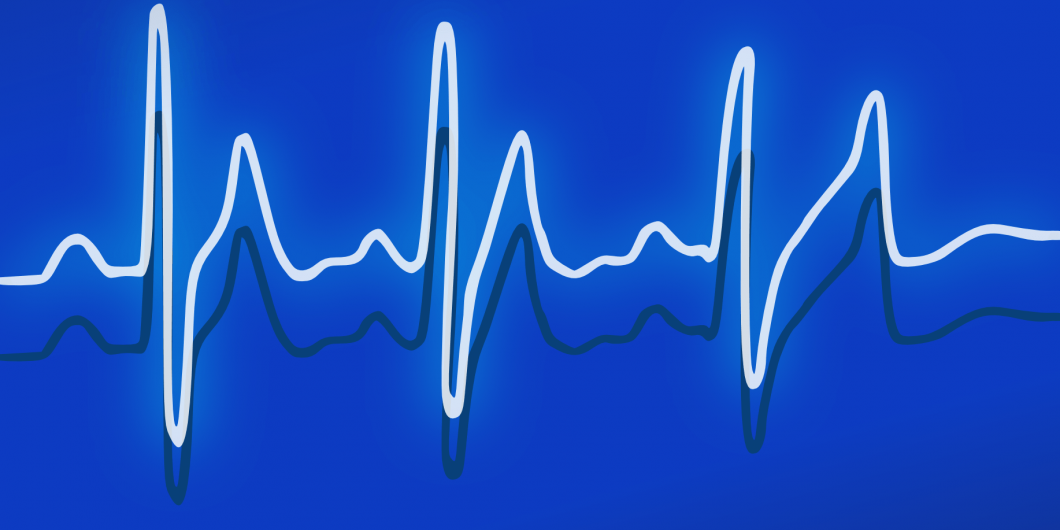 Ekg 158177 Via Pixabay Cc0 1.0